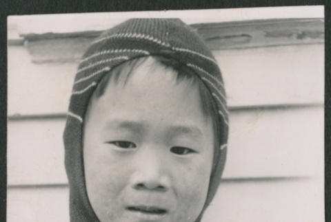 Boy with measles (ddr-densho-523-254)